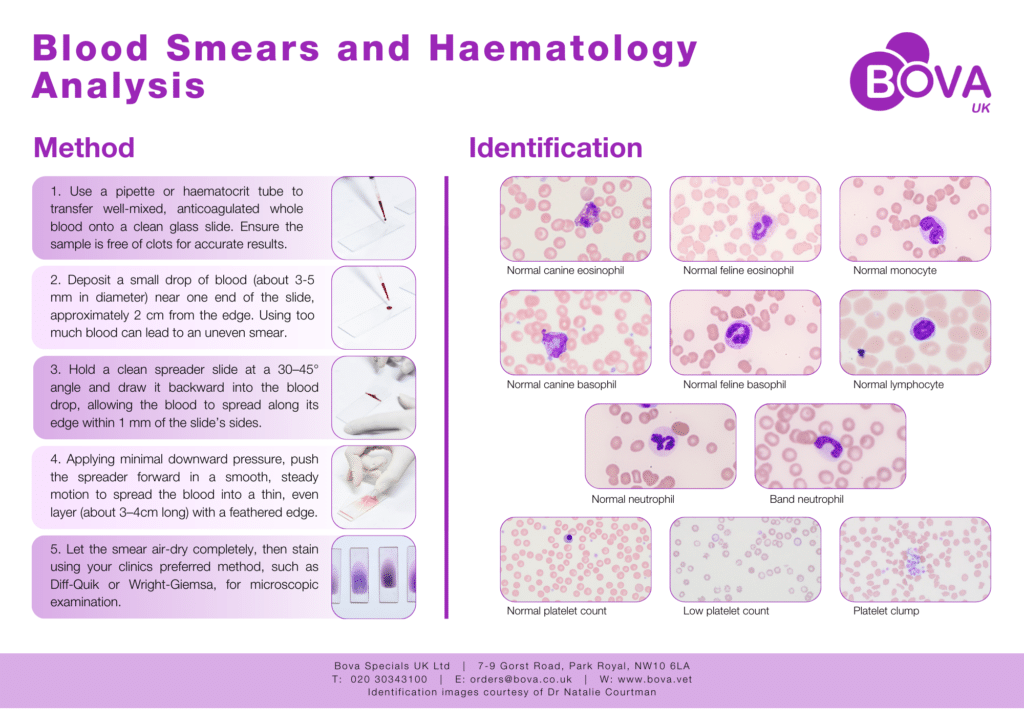 Blood Smears and Haematology Analysis Poster